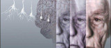 Dünya Alzheimer Günü