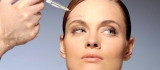 Migrene Botoxlu Çözüm